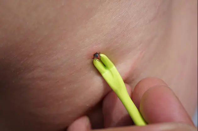 Ērču vilkšana ar ērču velkamo